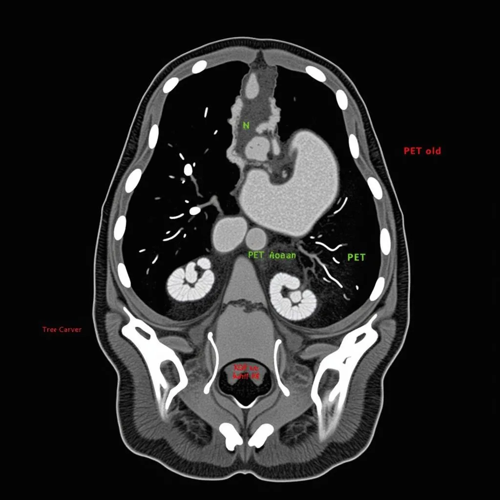 Combined PET/CT Scan Image